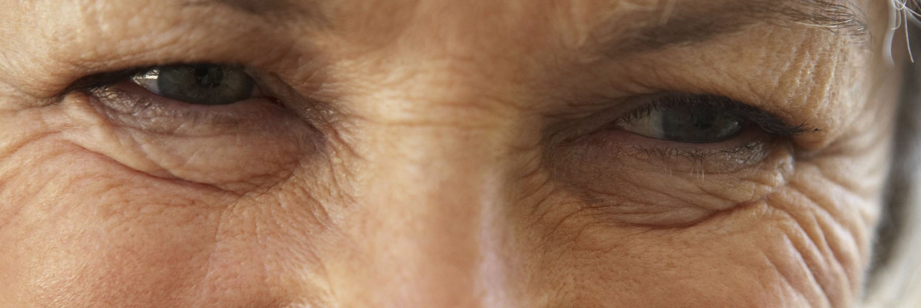 Wrinkles And Fine Lines Platinum Dermatology